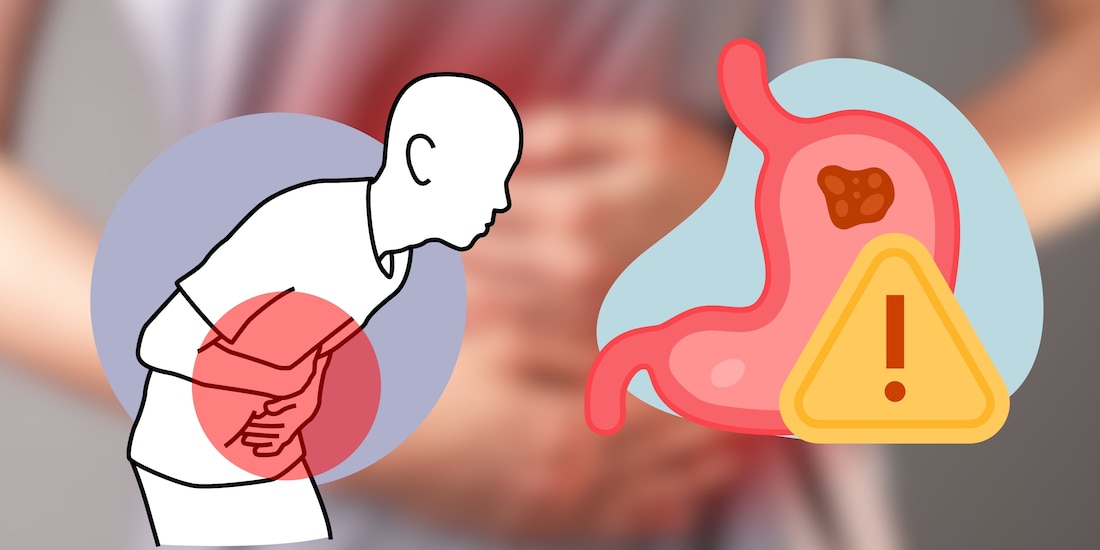 ¿Qué es la ciclosporiasis?