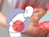 ¿Qué es la ciclosporiasis?