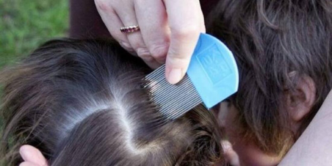 La mamá prefiere que su hija tenga piojos a matarlos, porque los veganos no matan seres vivos.