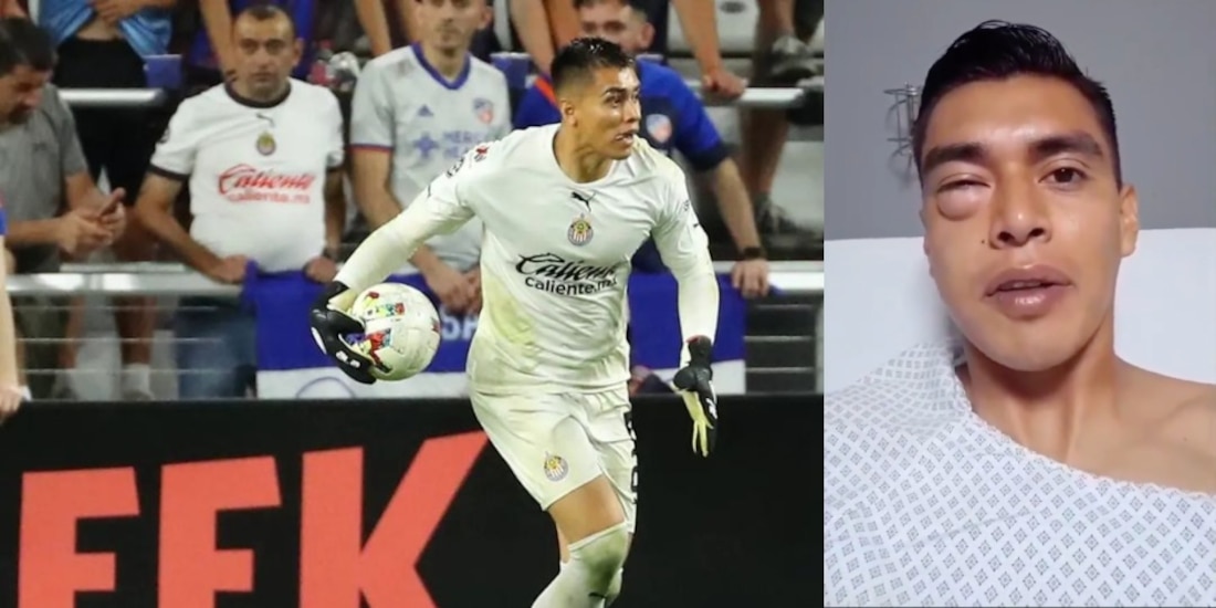 Así quedó el rostro del 'Tala' Rangel tras el fuerte golpe con el 'Pollo' Briseño