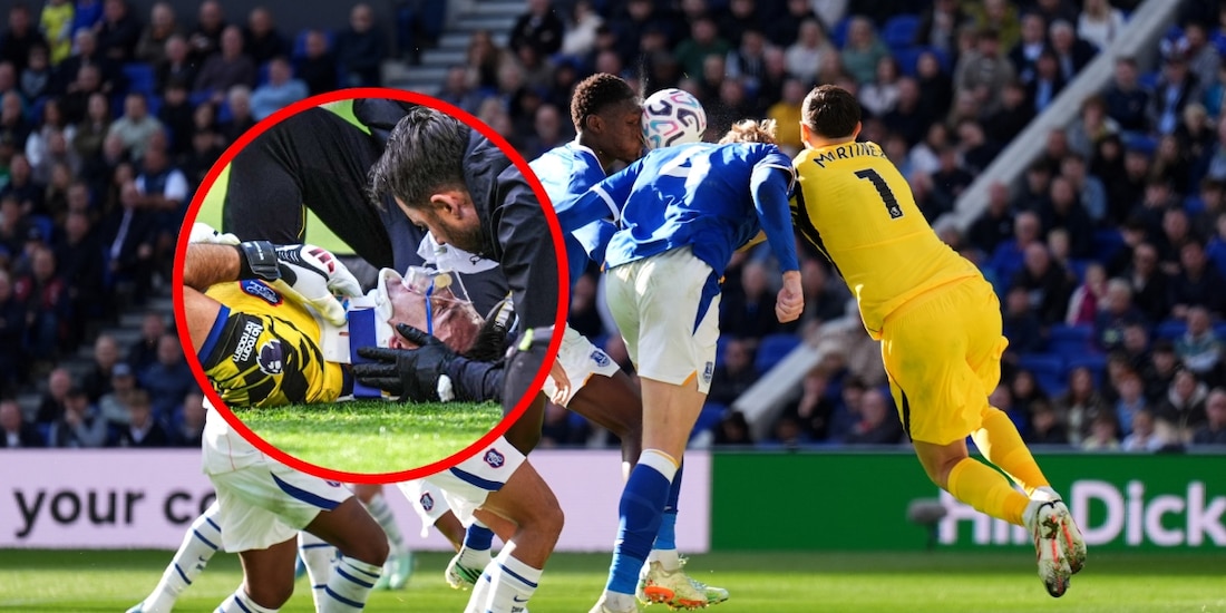 Emiliano Dibu Martínez en un choque en el partido Chelsea vs Everton en la Premier League