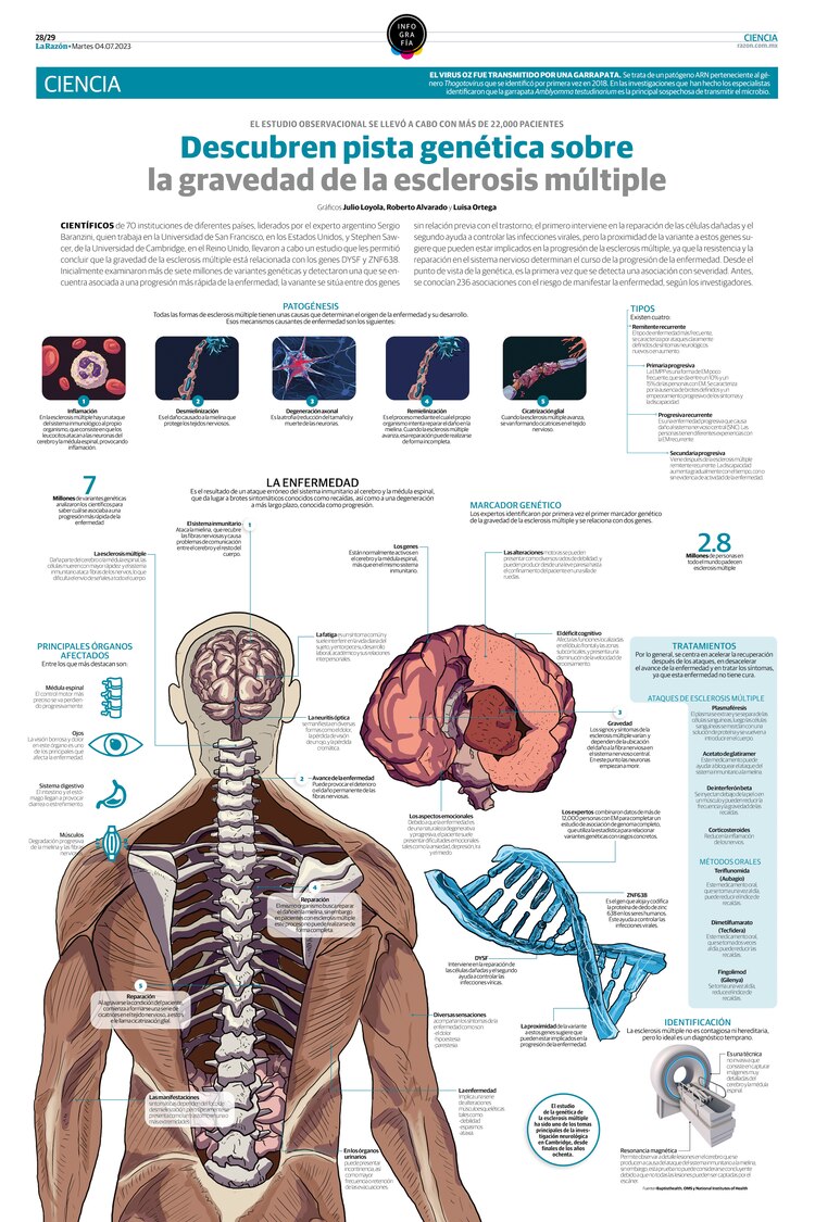 Esclerosis múltiple