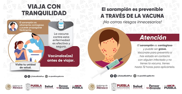 Vacuna contra sarampión