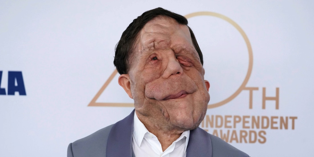 Adam Pearson tiene esposa.