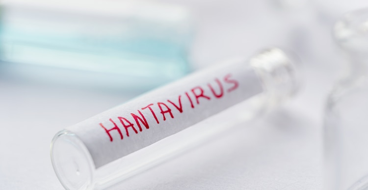 Hantavirus