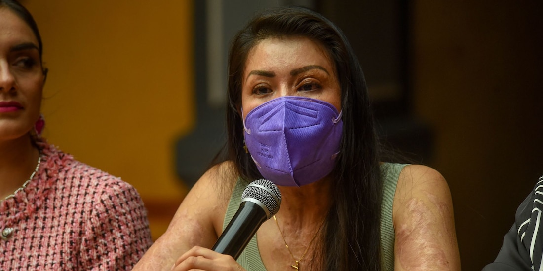 María Elena Ríos saxofonista y víctima de violencia ácida participó en el Foro Violencia Química o Ácida