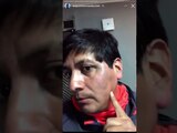 Augusto Hernández, conocido como "el acosador de TikTok, muestra los golpes que le propinó Juan de Dios Pantoja.