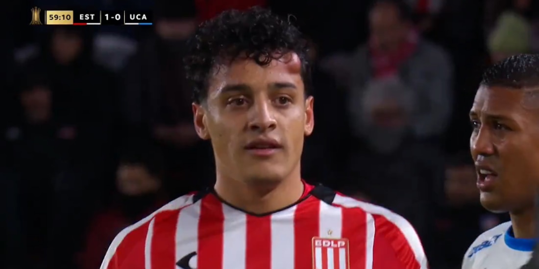 Jugador argentino recibió terrible golpe en la cabeza.