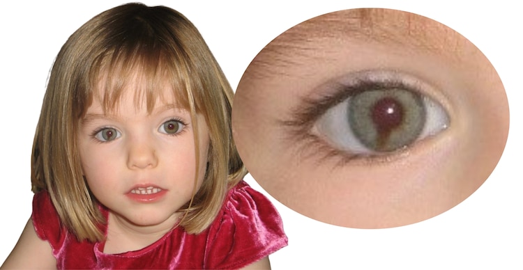 Característica ocular de Madeleine McCan