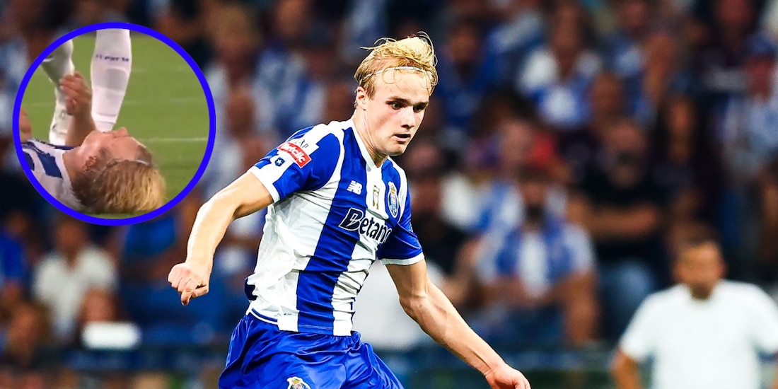 Victor Froholdt, compañero de Santiago Gimenez en el Porto, sufrió un terrible golpe en la mandíbula en el juego ante el Moreirense.