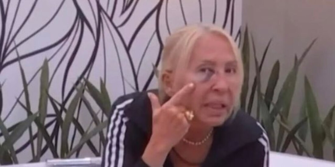 Laura Bozzo tiene tremendo golpe en la cara en La Casa de los Famosos 2