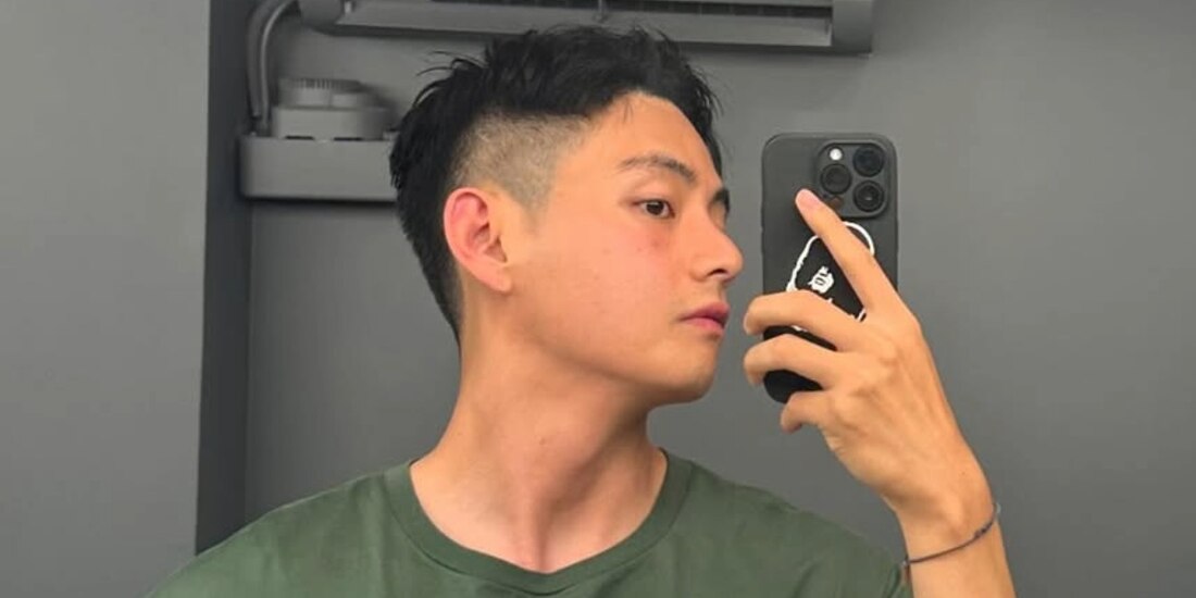 V de BTS sufrió una fractura.
