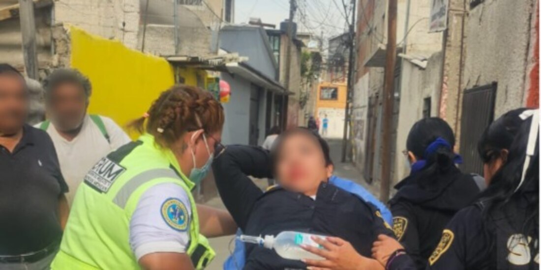 La agente de la SSC lesionada.