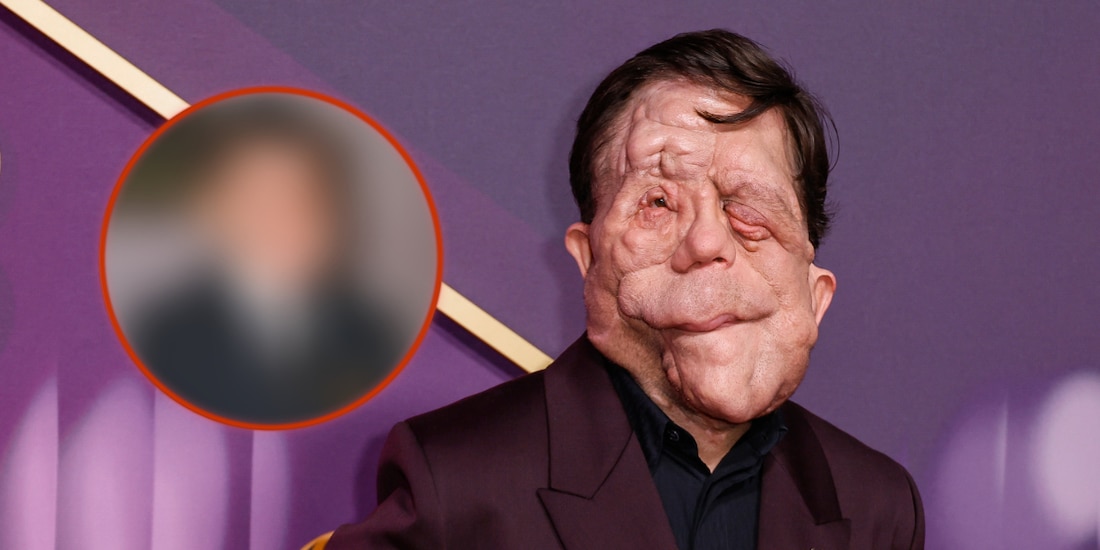 Así se veía Adam Pearson antes de su enfermedad.