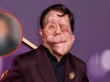 Así se veía Adam Pearson antes de su enfermedad.
