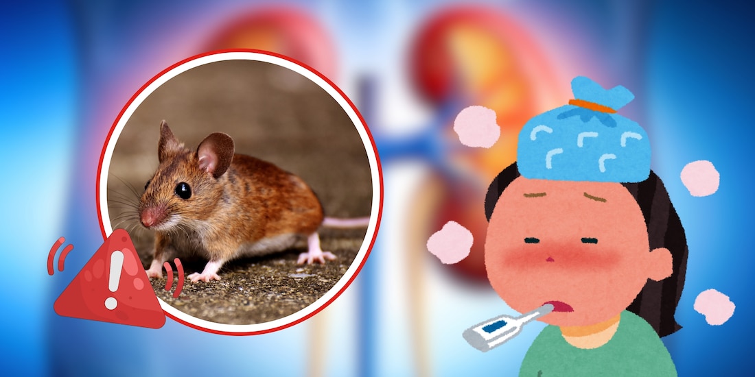 ¿Qué es la fiebre hemorrágica con síndrome renal?