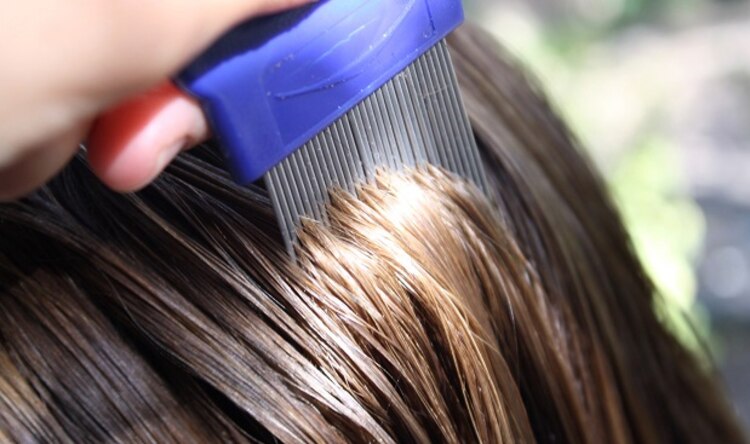 La mamá prefiere que su hija tenga piojos a matarlos, porque los veganos no matan seres vivos.