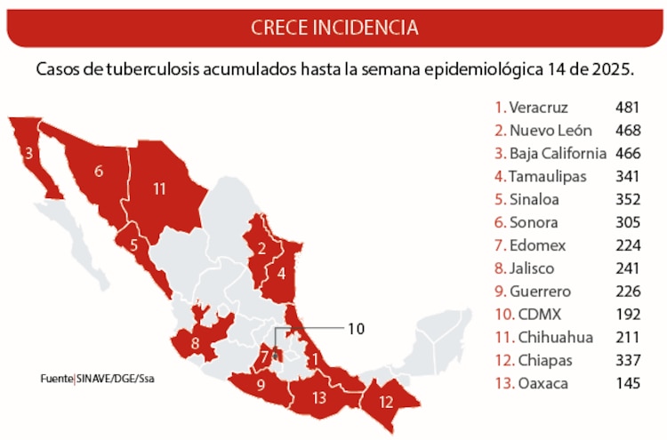 Crece incidencia │ Casos de tuberculosis acumulados hasta la semana epidemiológica 14 de 2025.