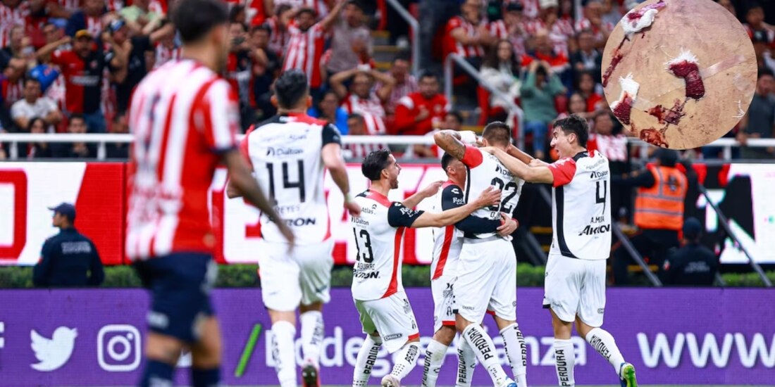 Aficionado de Atlas denunció agresión de parte de aficionados de Chivas en el duelo entre ambos en el play-in de la Liga MX. Foto: Especial