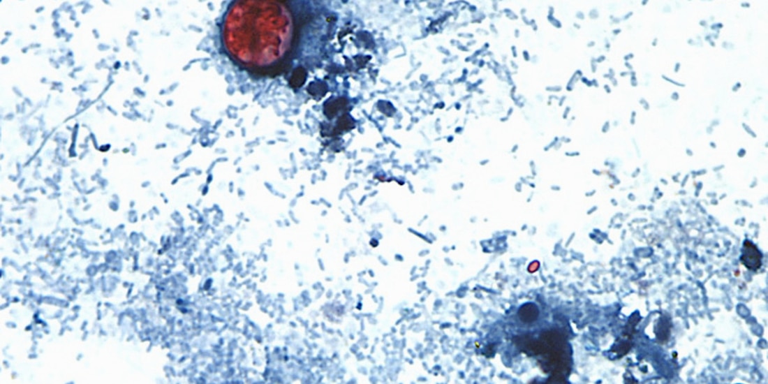 Esta fotografía tomada a través de un microscopio y difundida por los CDC muestra Cyclospora cayetanensis oocysts de una muestra de heces.