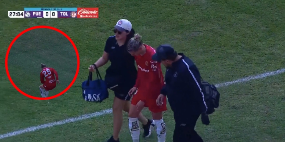 Faustine Robert, jugadora del Toluca Femenil, se lesionó el tobillo por el mal estado de la cancha del Puebla.