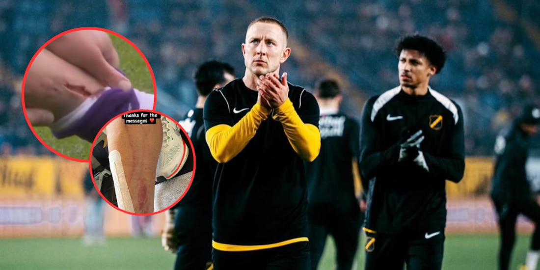 Lewis Holtby sufrió terrible golpe en su partido ante el Fortuna.