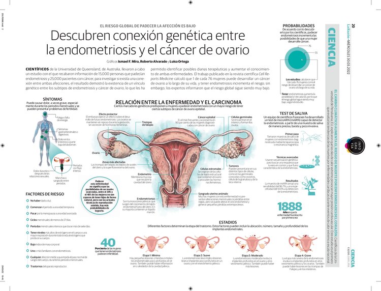 Descubren conexión genética entre la endometriosis y el cáncer de ovario