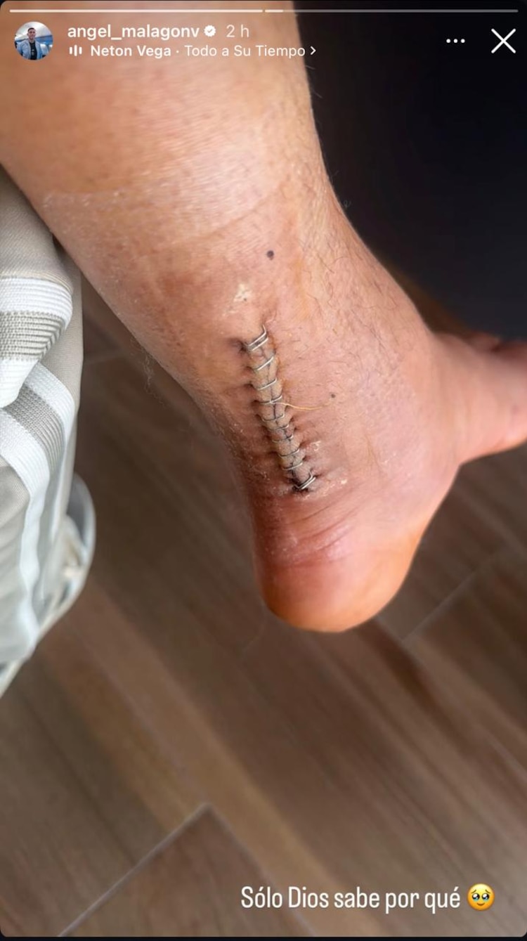 La pierna de Luis Ángel Malagón.