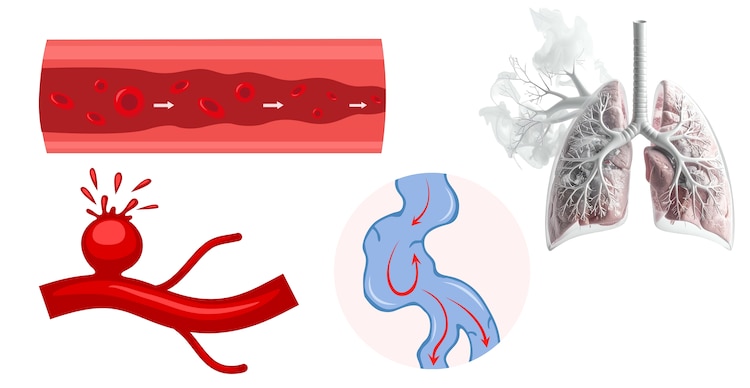 Padecimientos de salud de Jesún Murillo Karam