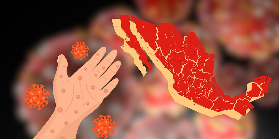 Casos de sarampión confirmados en México