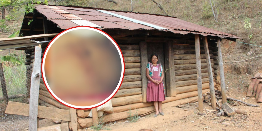 Inés Ramírez Pérez, la mujer oaxaqueña que se realizó una cesárea a ella misma