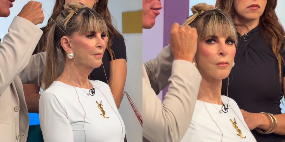 Shanik Berman se somete a tratamiento con hilos y transforma su rostro en vivo