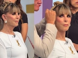 Shanik Berman se somete a tratamiento con hilos y transforma su rostro en vivo