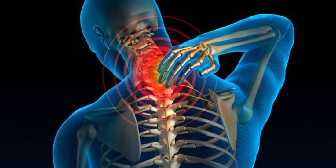 El mieloma múltiple se diagnostica tardíamente en muchas ocasiones.