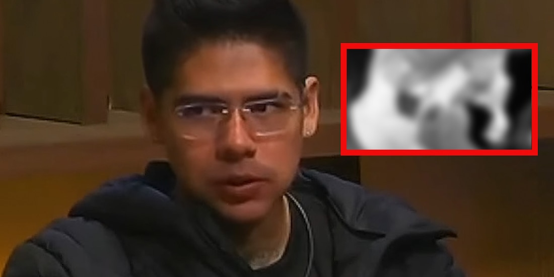 Así le quedó el dedo a Antrax tras cortárselo en MasterChef