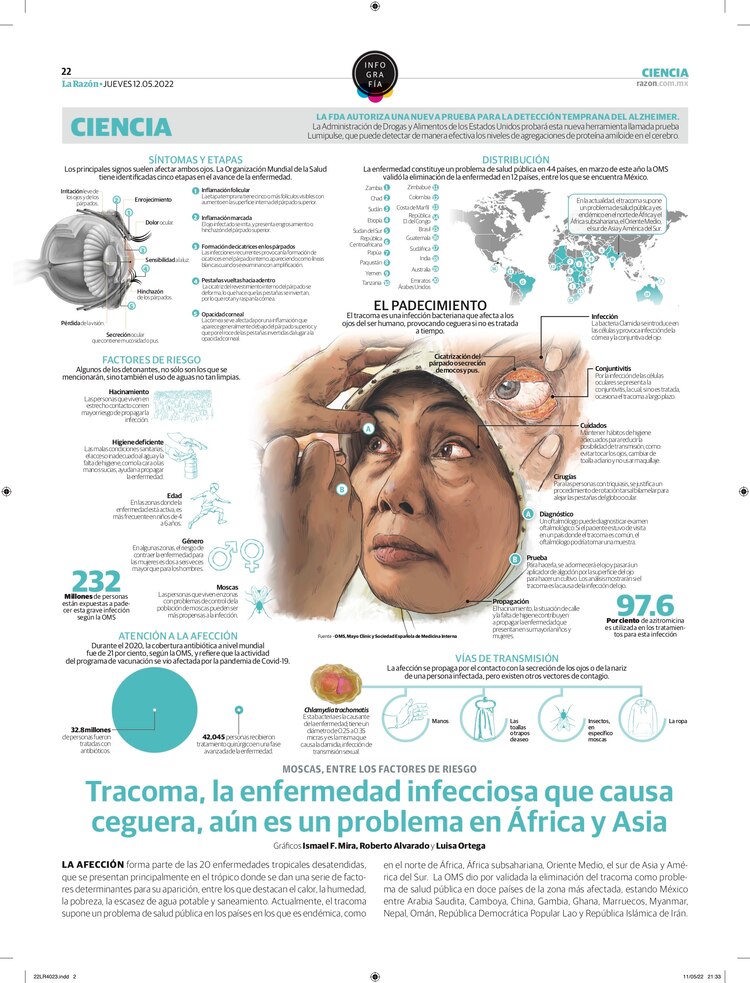 Tracoma