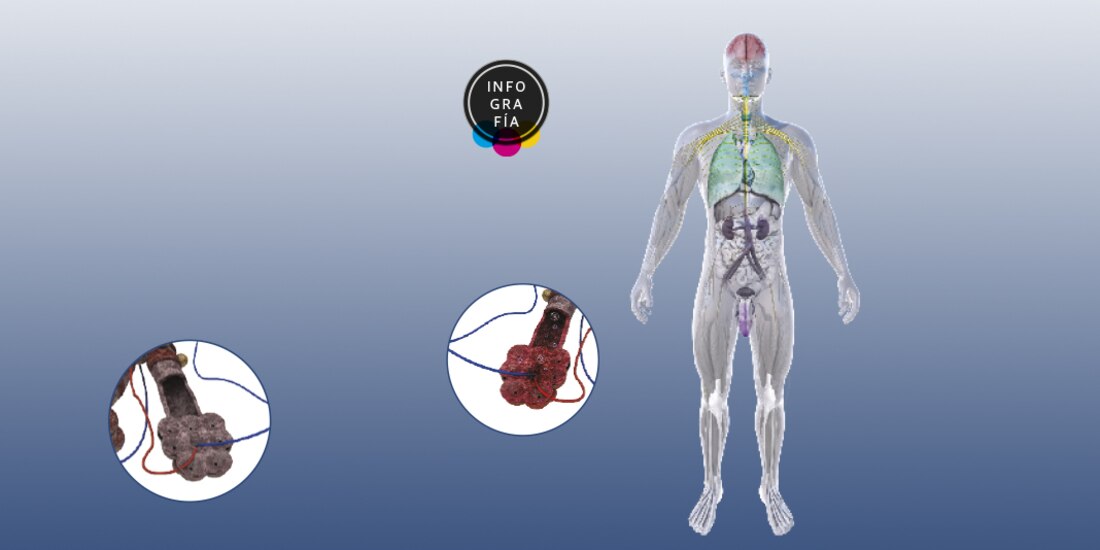 Contaminación del aire