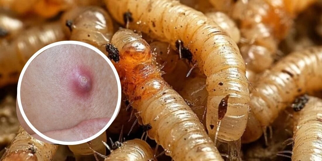 Confirman muertes de tres adultas mayores con infestación por gusano barrenador en México