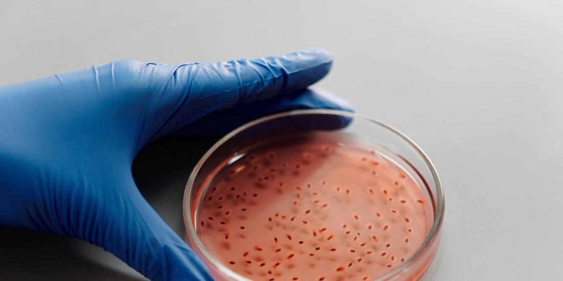Localizan brote de Salmonella en el Hospital General de México