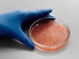 Localizan brote de Salmonella en el Hospital General de México