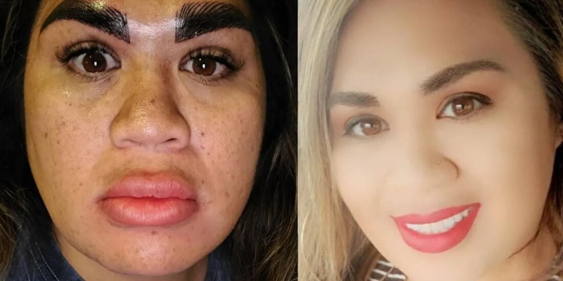 "Me destrozaron la cara": Mujer paga más de 7 mil pesos por microblading y así la dejaron