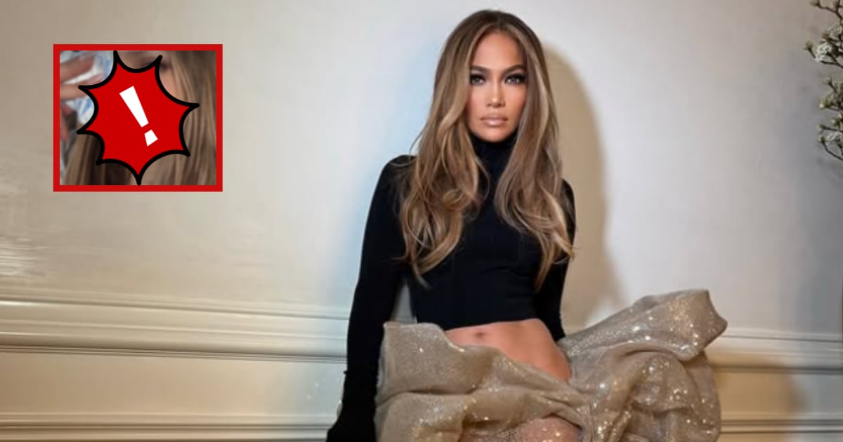 Jennifer López sufre un accidente en el rostro que requirió puntadas ...